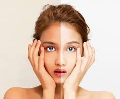 Beyond Whitening: Synlotic Biotech's Scientific Approach to Brighter, Even-Toned Skin